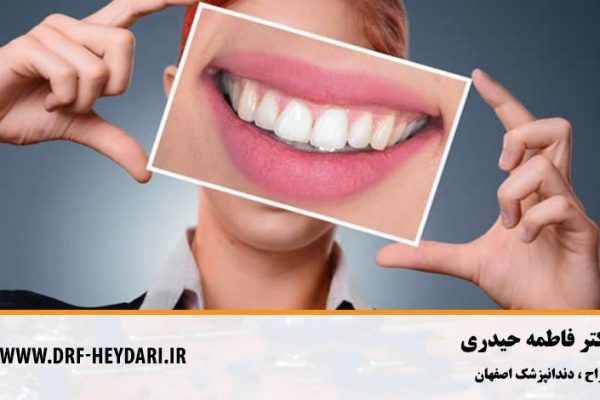 دندانپزشک زیبایی و ترمیمی اصفهان