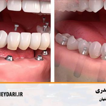 بهترین دندانپزشک اصفهان