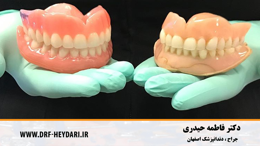 پروتزهای دندانی اصفهان