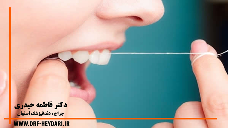 کشیدن نخ دندان
