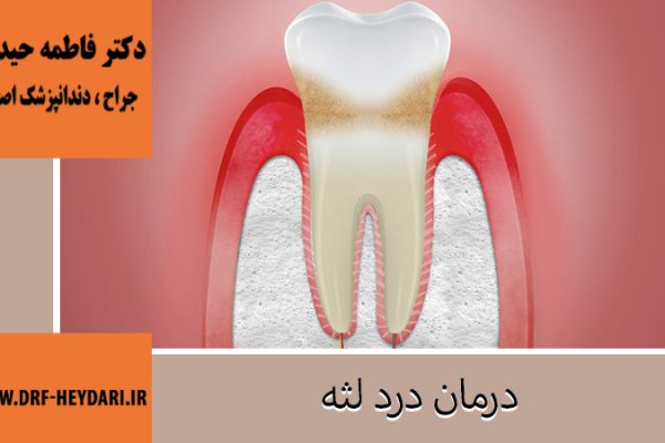 دلایل و درمان درد لثه