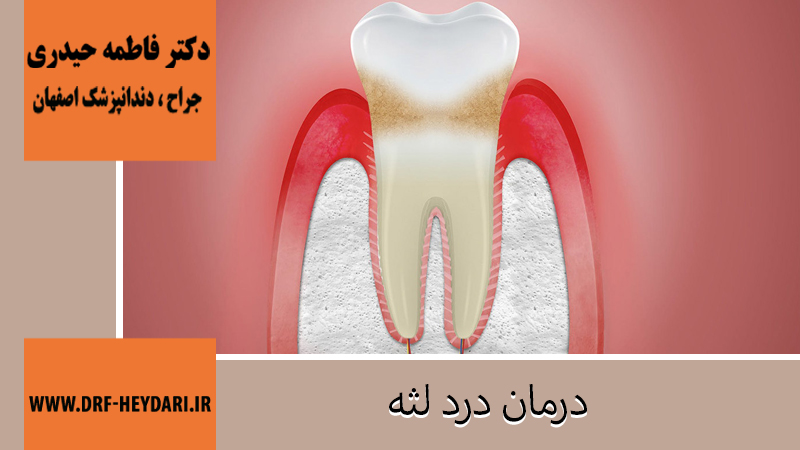 دلایل و درمان درد لثه