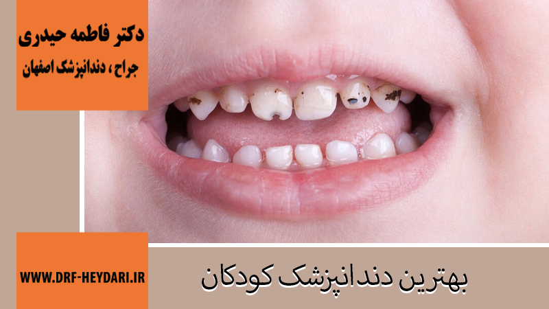 جراح-دندانپزشک-اصفهان | بهترین-دندانپزشک-اصفهان