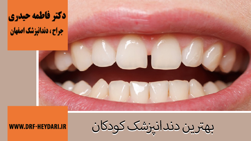 جراح و دندانپزشک در اصفهان | دکتر فاطمه حیدری