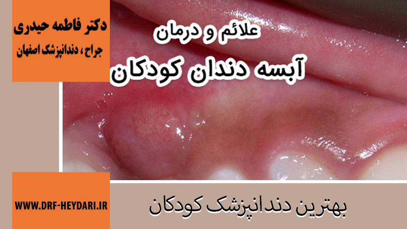 جراح و دندانپزشک در اصفهان | دکتر فاطمه حیدری