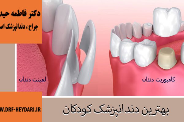 جراح و دندانپزشک در اصفهان | دکتر فاطمه حیدری | بهترین دندانپزشک اصفهان