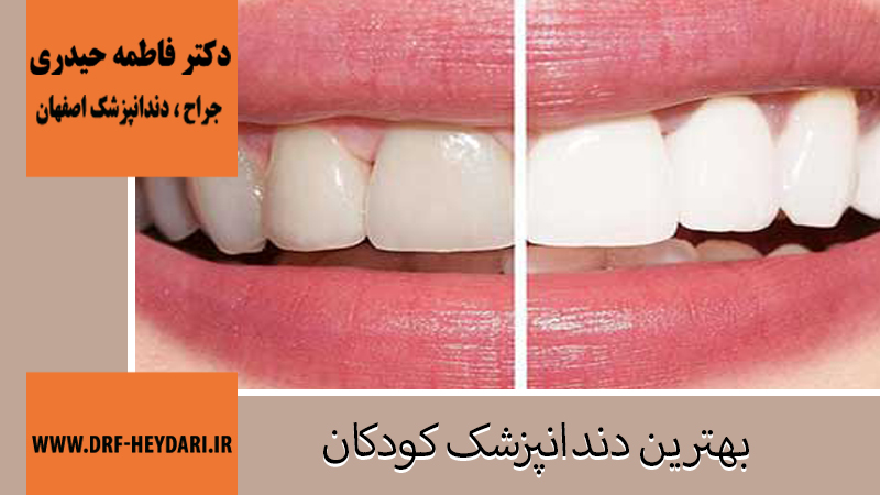 جراح و دندانپزشک در اصفهان | دکتر فاطمه حیدری | بهترین دندانپزشک اصفهان