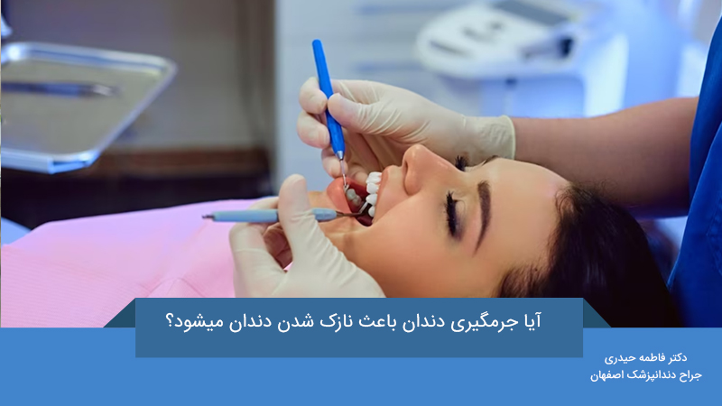 جرمگیری دندان