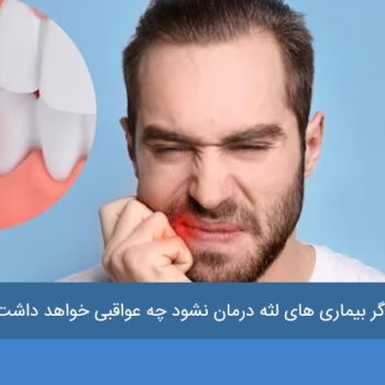 بیماری های لثه