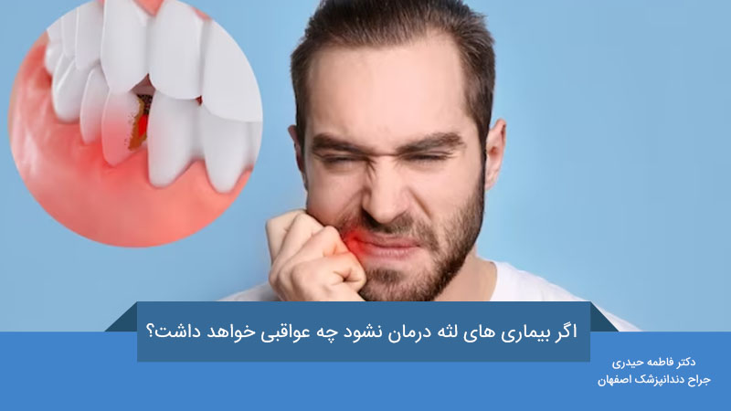بیماری های لثه