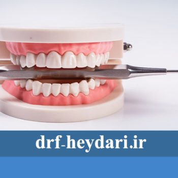 چرا دندان مصنوعی ؟