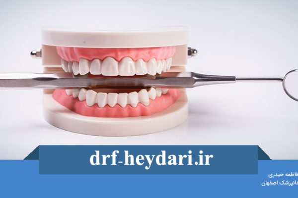 چرا دندان مصنوعی ؟