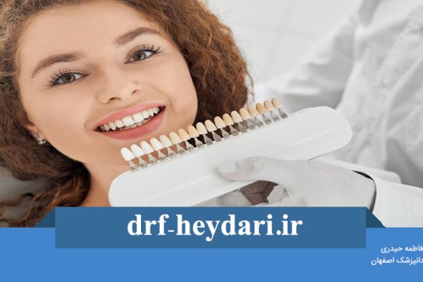 راه‌هایی برای داشتن لبخند زیبا و جذاب