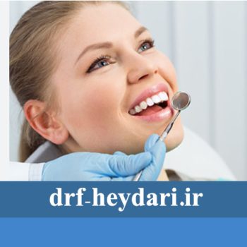 علل فواصل بین دندان‌ها