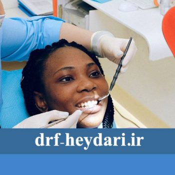 درمان فاصله بین دندان‌ها با ارتودنسی