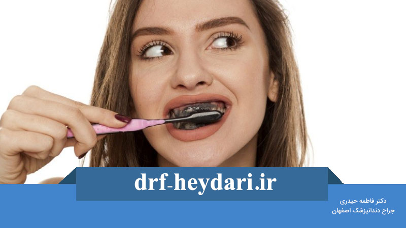 گیر غذایی بعد از ایمپلنت