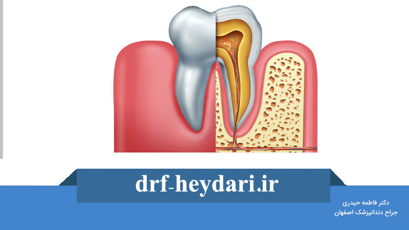 کانال دندان چیست