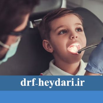 اقدامات مهم بعد از کشیدن دندان کودکان