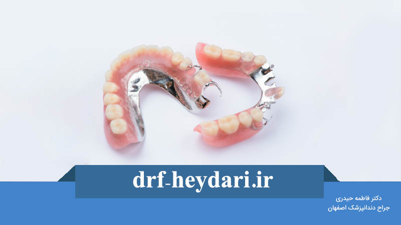 پارسیل کروم کبالت
