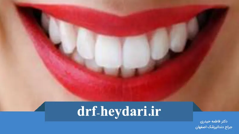 تأثیر فرم لبها بر زیبایی لبخند