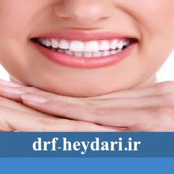 دندانهای سفید
