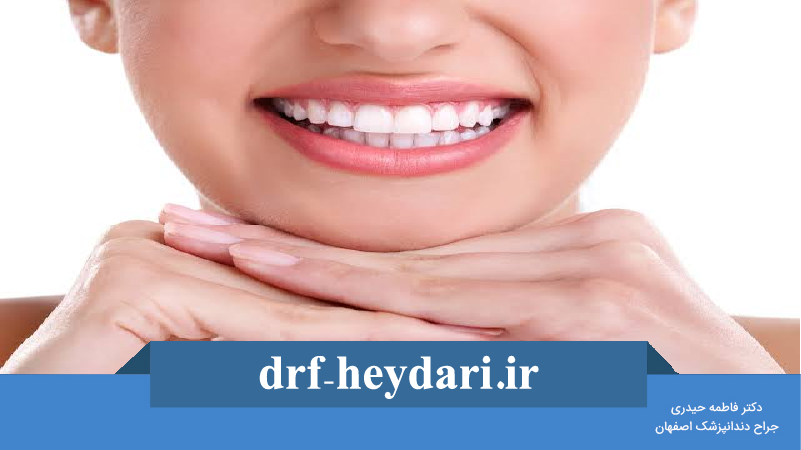 دندانهای سفید