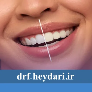 نقش بهداشت دهان
