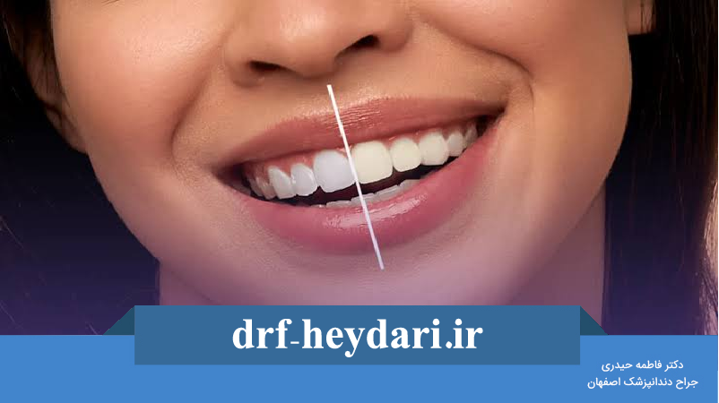 نقش بهداشت دهان