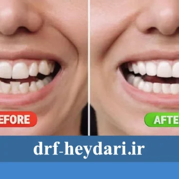 نقش ارتودنسی در اصلاح مشکلات فک