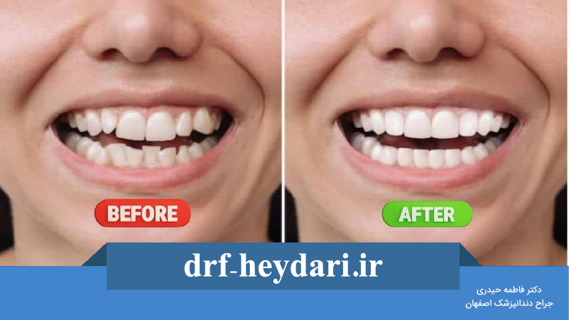نقش ارتودنسی در اصلاح مشکلات فک